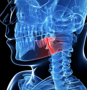 Frenectomy Surgery - Michigan OMS in Metro Detroit - jaw2